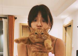 患胆结石的明星网红