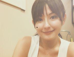 患胆结石的明星网红